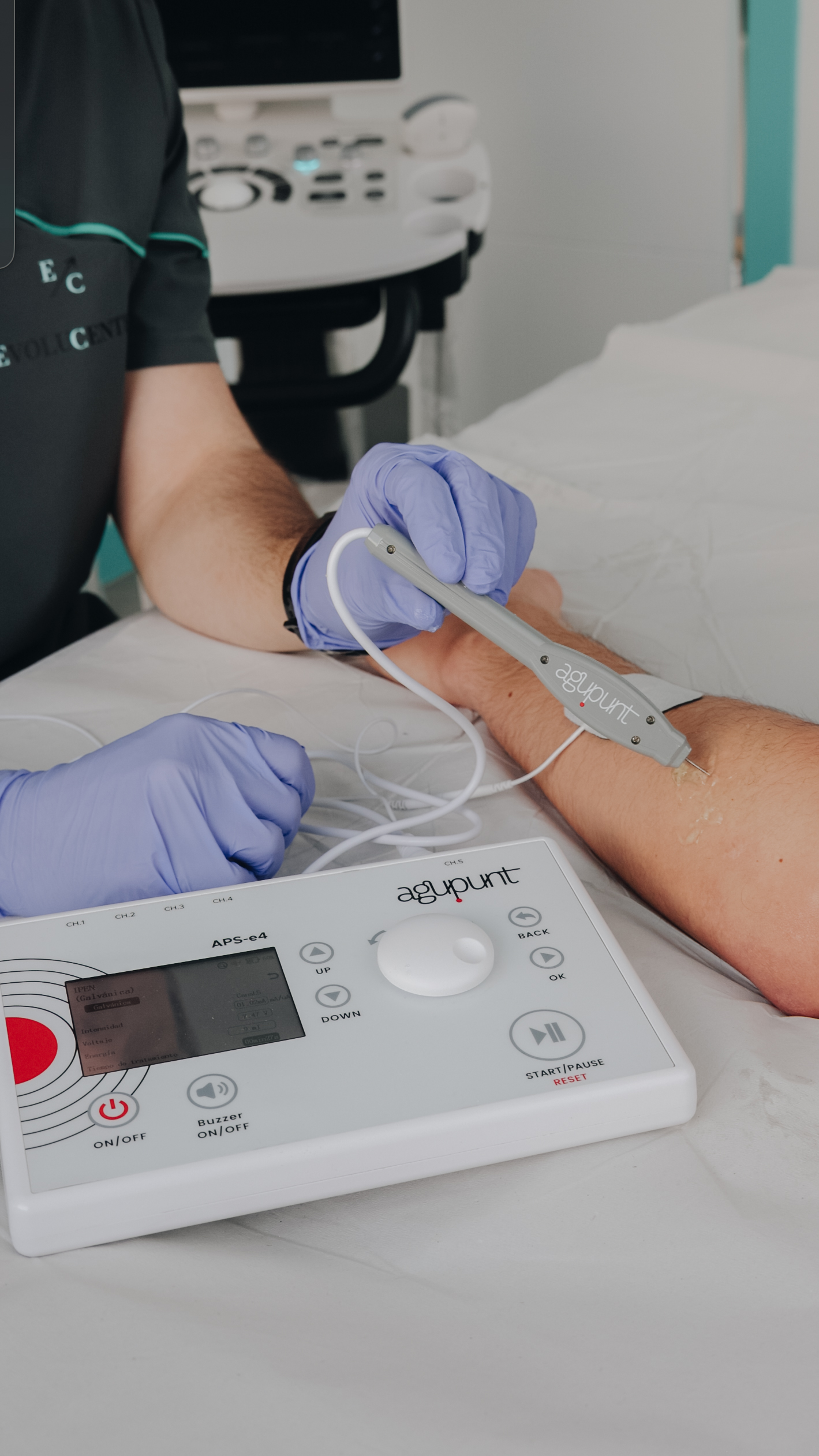 Tratamiento de electrólisis percutánea terapéutica guiada por ecografía en fisioterapia