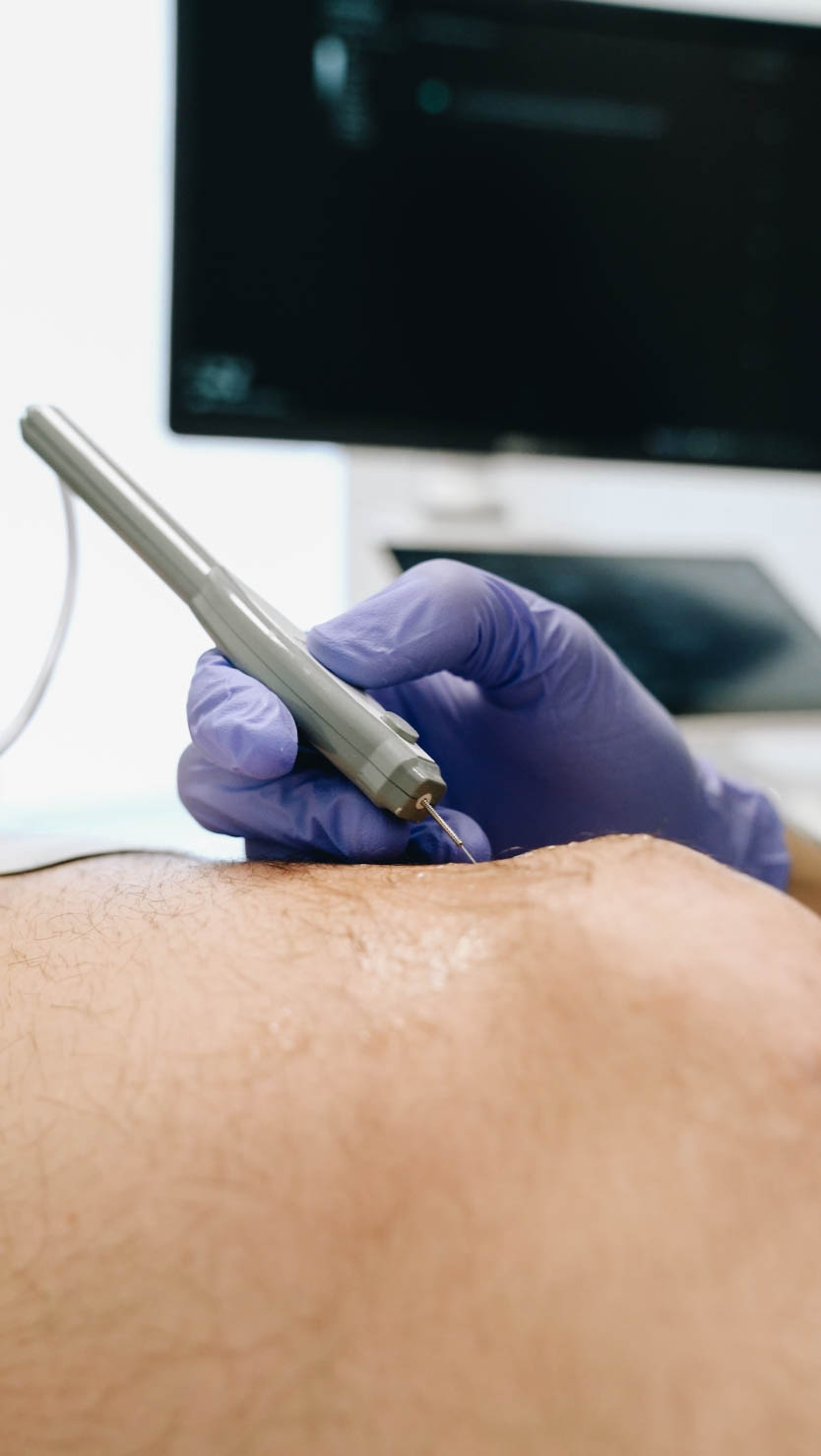 Aplicación de EPTE en tratamiento de regeneración tisular