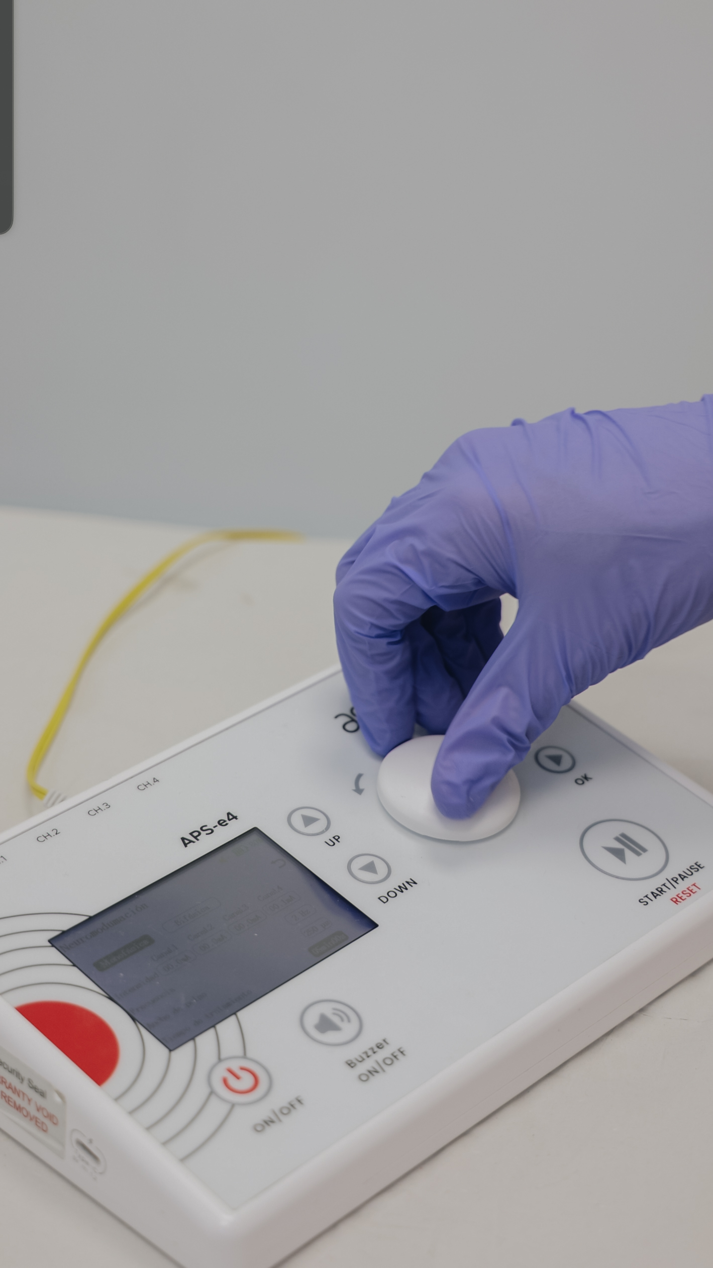 Neuromodulación percutánea guiada por ecografía