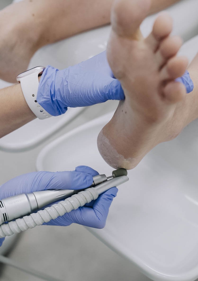 Consulta de podología en EvoluCenter