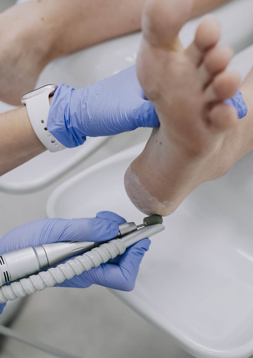 Consulta de podología en EvoluCenter