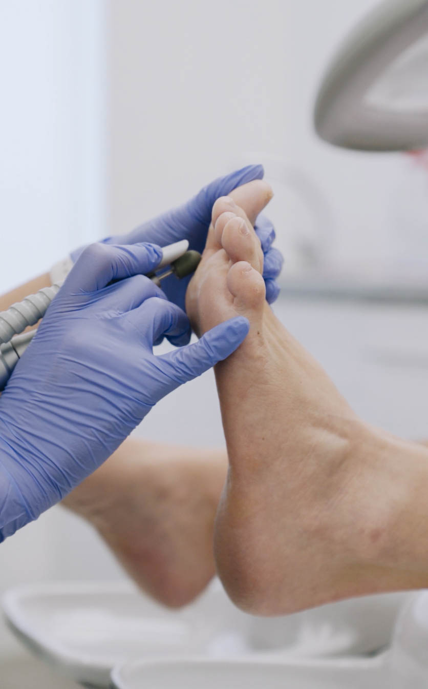 Tratamiento de quiropodia en consulta