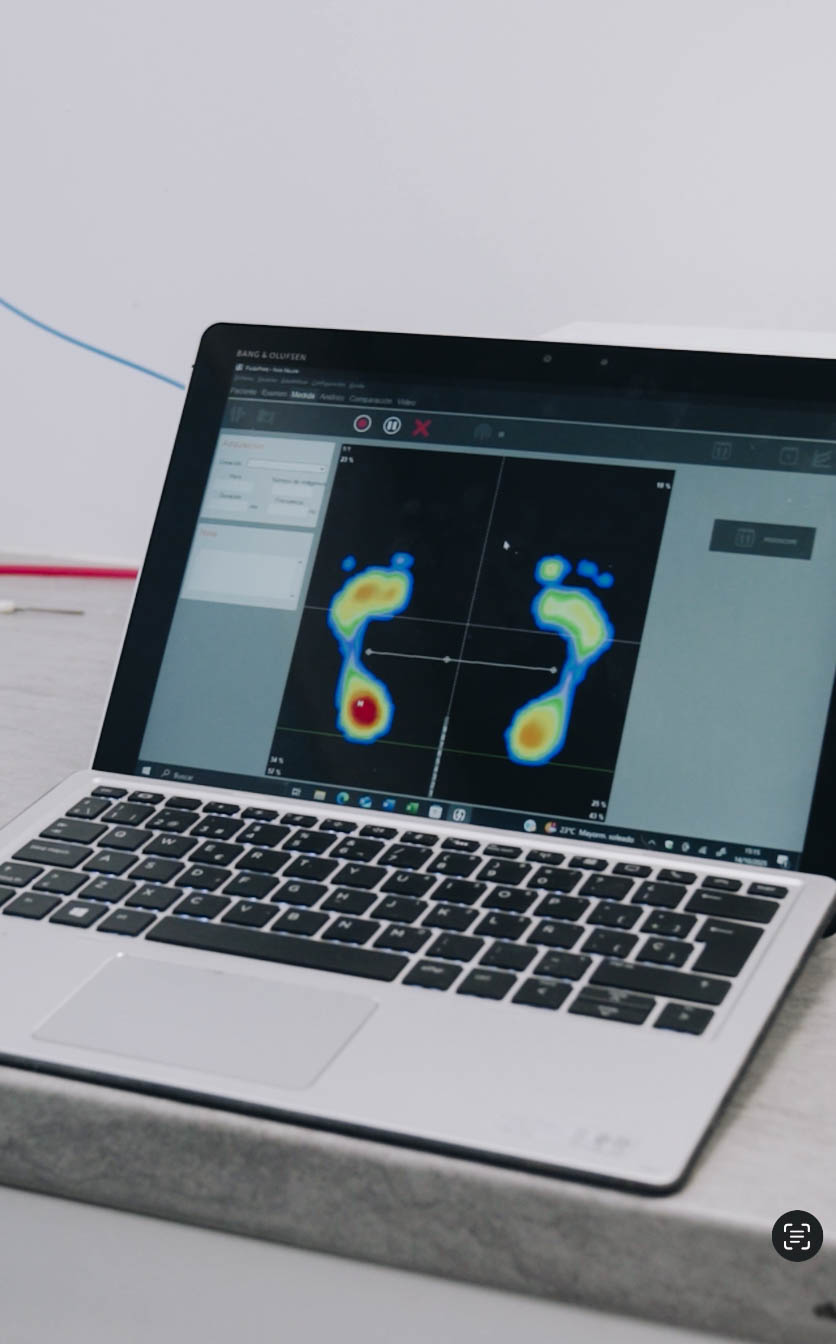 Estudio de la pisada y plantillas ortopédicas